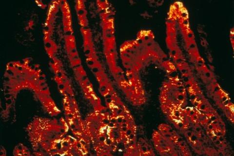 Rôle des fibres dans l'obésité et le diabète
